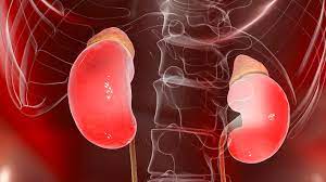 World Kidney Day