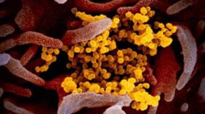 WHO classified Indian coronavirus variant as a "global variant of concern" | डब्ल्यूएचओने भारतीय कोरोनाव्हायरस प्रकाराला जागतिक पातळीवरील चिंता म्हणून वर्गीकृत केले_2.1