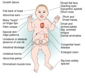 मानवी रोग: रोगांचे वर्गीकरण आणि रोगांचे कारणे | Classification of Diseases and Causes of Diseases_290.1