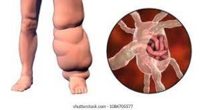 मानवी रोग: रोगांचे वर्गीकरण आणि रोगांचे कारणे | Classification of Diseases and Causes of Diseases_280.1