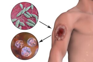 मानवी रोग: रोगांचे वर्गीकरण आणि रोगांचे कारणे | Classification of Diseases and Causes of Diseases_250.1