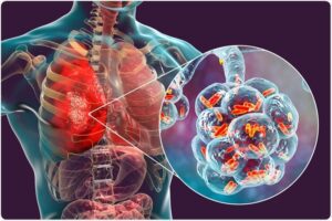 मानवी रोग: रोगांचे वर्गीकरण आणि रोगांचे कारणे | Classification of Diseases and Causes of Diseases_210.1