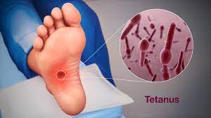 मानवी रोग: रोगांचे वर्गीकरण आणि रोगांचे कारणे | Classification of Diseases and Causes of Diseases_200.1