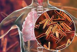 मानवी रोग: रोगांचे वर्गीकरण आणि रोगांचे कारणे | Classification of Diseases and Causes of Diseases_160.1
