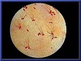 मानवी रोग: रोगांचे वर्गीकरण आणि रोगांचे कारणे | Classification of Diseases and Causes of Diseases_150.1