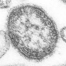 मानवी रोग: रोगांचे वर्गीकरण आणि रोगांचे कारणे | Classification of Diseases and Causes of Diseases_70.1