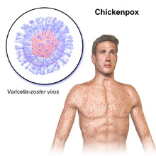 मानवी रोग: रोगांचे वर्गीकरण आणि रोगांचे कारणे | Classification of Diseases and Causes of Diseases_50.1