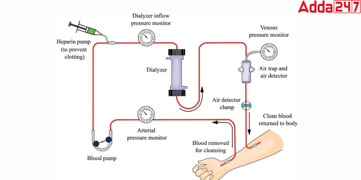 Excretion in Humans, Process, Diagram, System, Function -_5.1