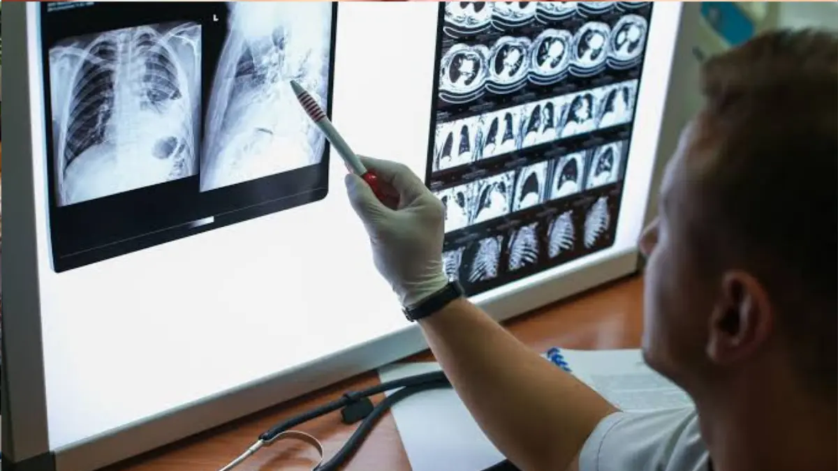 OSSSC Radiographer Recruitment 2026